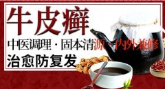 中药可以治疗牛皮癣吗？ 治疗效果怎么样？