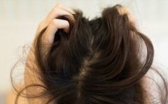 女性牛皮癣该怎样治疗