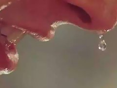 运动可帮助牛皮癣患者排除毒素减轻病情